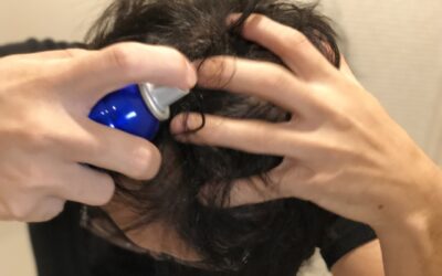 【ハゲ対策】使えんゾっ、、の件